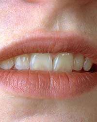 Imagen Protocolo & Etiqueta. La boca, los labios, los dientes y la lengua. Cortesía y modales.